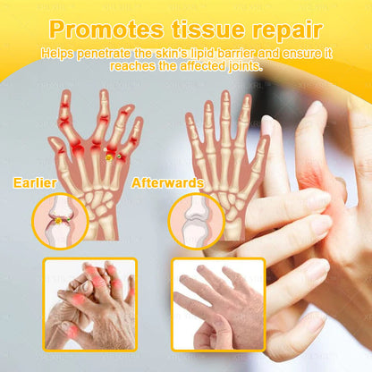 XRLXRL® Bee Venom Pain-Relief Bone Healing Cream (Specially for older adults)🏝️