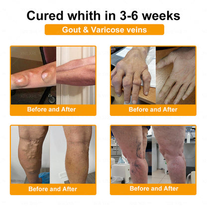 XRLXRL® Bee Venom Pain-Relief Bone Healing Cream (Specially for older adults)🏝️
