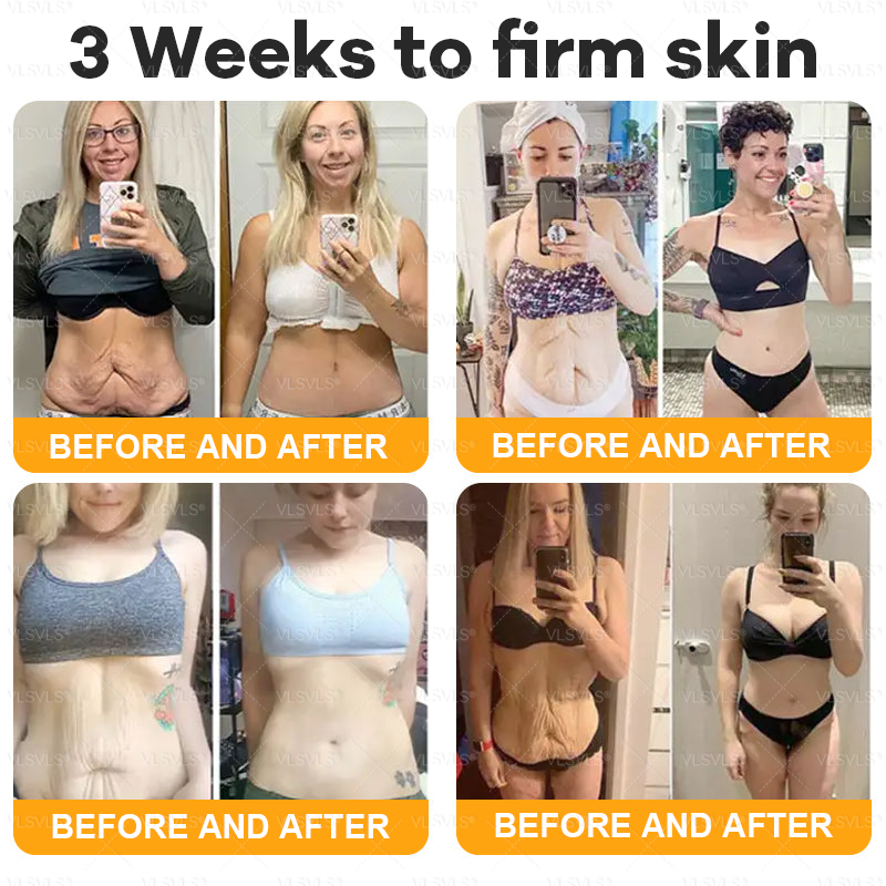 Made and Shipped from USA  🗽𝑽𝑳𝑺𝑽𝑳𝑺® Bee Venom Comprehensive Cream  LAST DAY 80% OFF(Sagging Skin, Fine Lines, Loss of Firmness, Flat Bust, Drooping Hips, and More)