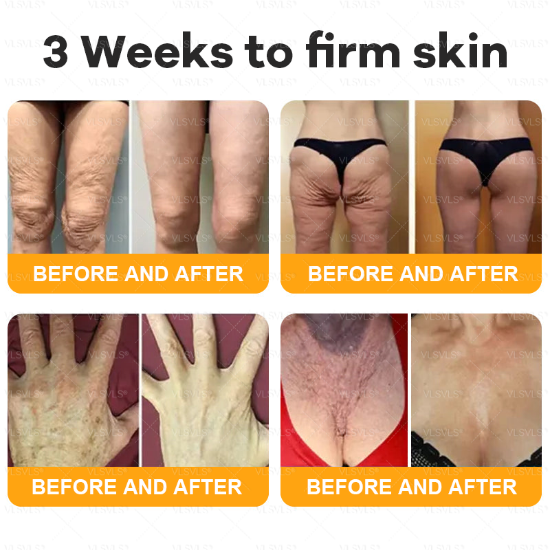 Made and Shipped from USA  🗽𝑽𝑳𝑺𝑽𝑳𝑺® Bee Venom Comprehensive Cream  LAST DAY 80% OFF(Sagging Skin, Fine Lines, Loss of Firmness, Flat Bust, Drooping Hips, and More)