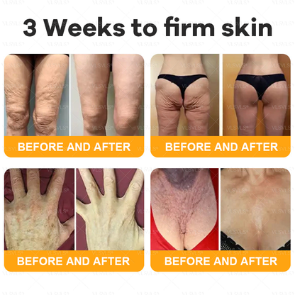 Made and Shipped from USA  🗽𝑽𝑳𝑺𝑽𝑳𝑺® Bee Venom Comprehensive Cream  LAST DAY 80% OFF(Sagging Skin, Fine Lines, Loss of Firmness, Flat Bust, Drooping Hips, and More)