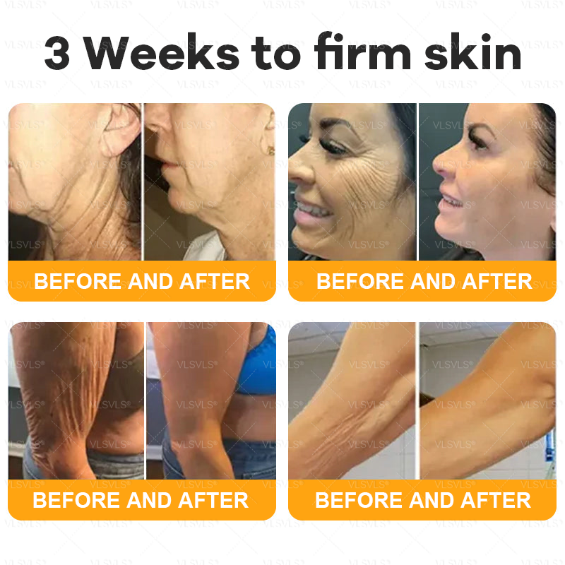 Made and Shipped from USA  🗽𝑽𝑳𝑺𝑽𝑳𝑺® Bee Venom Comprehensive Cream  LAST DAY 80% OFF(Sagging Skin, Fine Lines, Loss of Firmness, Flat Bust, Drooping Hips, and More)