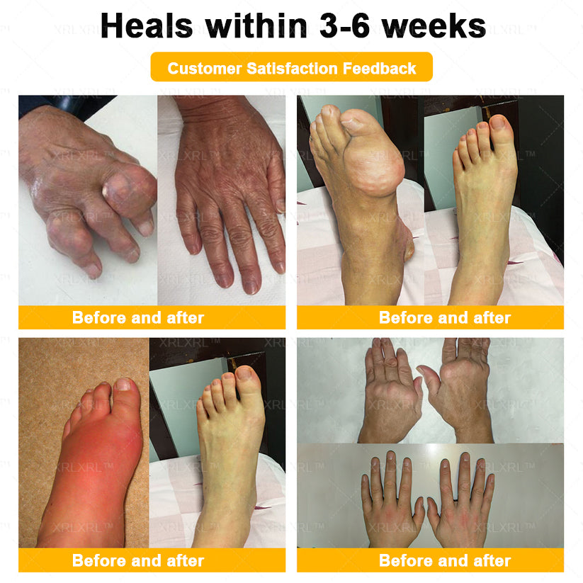 XRLXRL® Bee Venom Pain-Relief Bone Healing Cream (Specially for older adults)🏝️