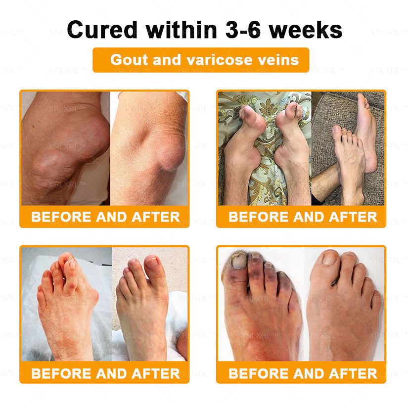 XRLXRL® Bee Venom Pain-Relief Bone Healing Cream (Specially for older adults)🏝️