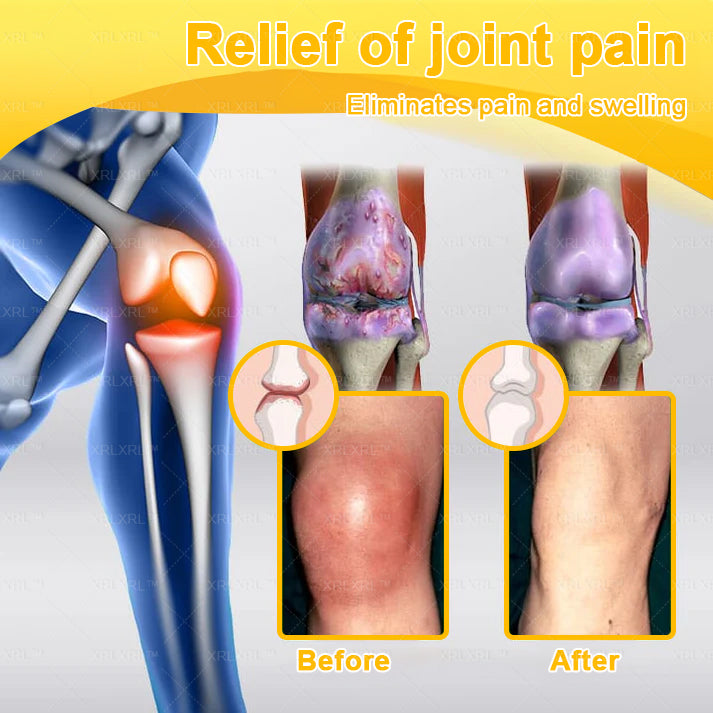 XRLXRL® Bee Venom Pain-Relief Bone Healing Cream (Specially for older adults)🏝️